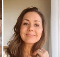 Emface-review-before-and-after3.jpg
